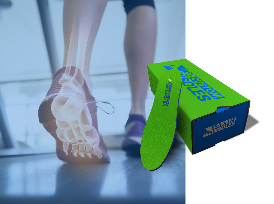 Diy shoe inserts for comfort discount
